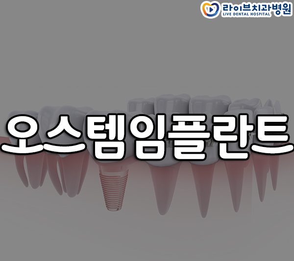 오스템임플란트 받아도 될까요? 관련 이미지 1
