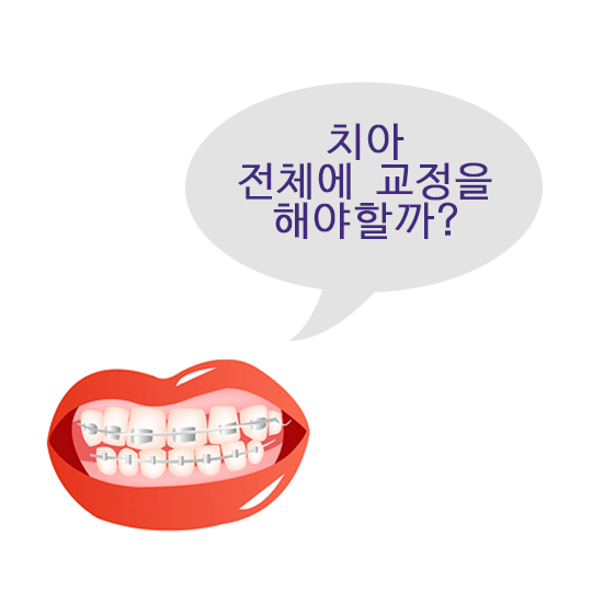 부분교정, 빠른 교정을 할 수 있다? 관련 이미지 2