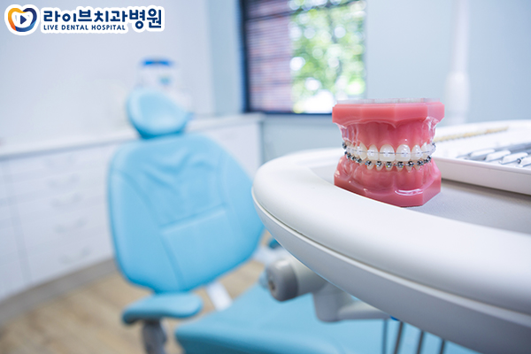 설측교정 안보이는 교정을 찾는다면 관련 이미지 4