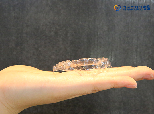 투명교정, 결혼이나 면접을 앞두고 있어도 오케이! 관련 이미지 3