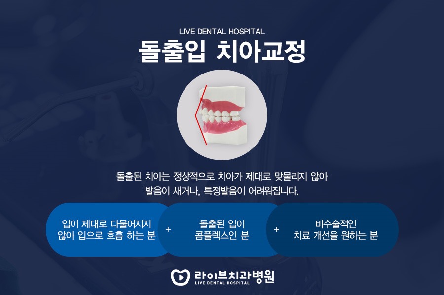비발치 교정 치아 발치 없이 해봐도 될까요???? 관련 이미지 3