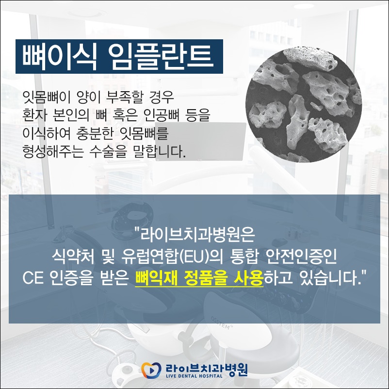 임플란트재수술 선택을 앞두고 있다면? 관련 이미지 9