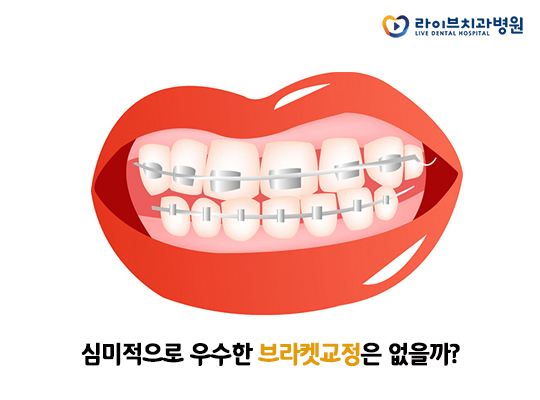 세라믹교정, 심미성을 높여 치료부담을 낮추다 관련 이미지 2