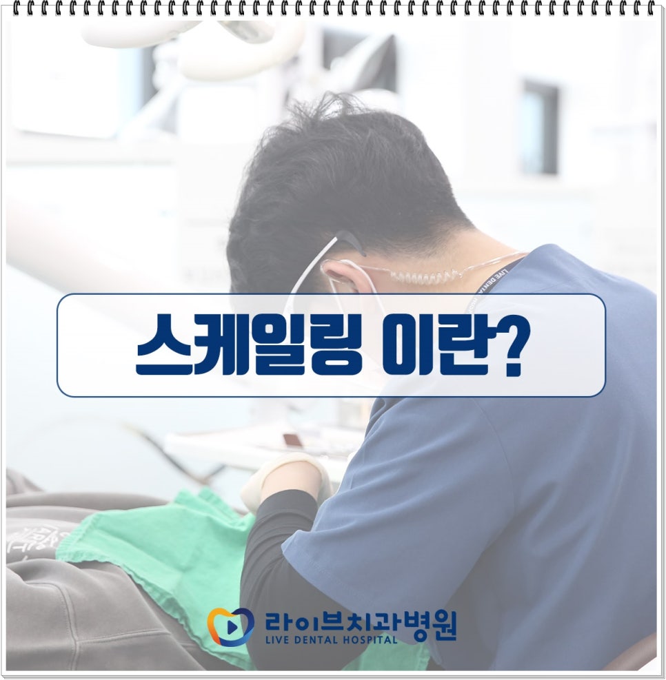 치석제거를 위한 스케일링 궁금증 풀어봐요 관련 이미지 2