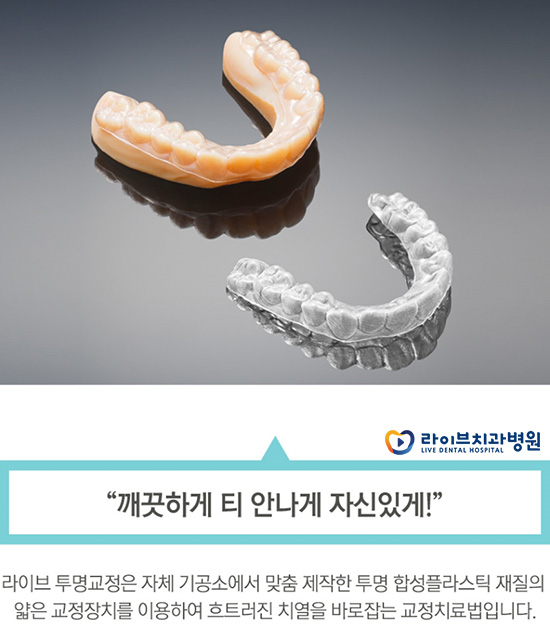 투명교정, 티나지 않는 교정을 원한다면? 관련 이미지 5