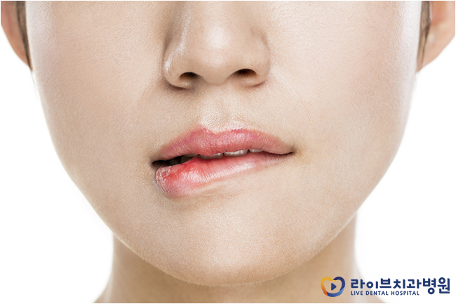 돌출입교정 올바른 치료계획을 세우자 관련 이미지 2