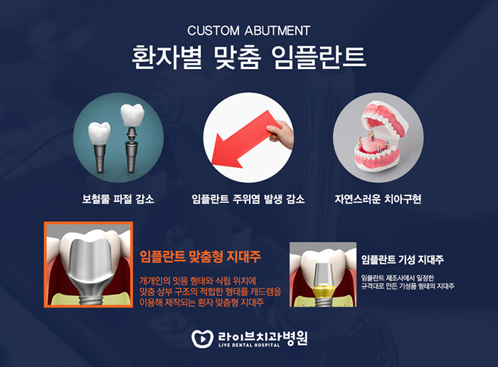 역삼동 임플란트 고민하신다면 관련 이미지 3