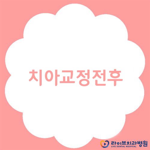 치아교정전후 결과 좋은 부평치과 관련 이미지 1