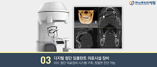임플란트 틀니 어떨 때 하는걸까요? 관련 이미지 6