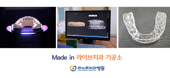 투명교정, 자체 제작으로 만족도 UP! 관련 이미지 3