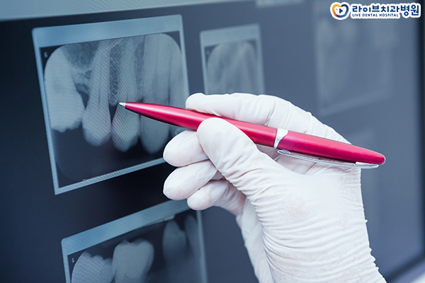 비발치교정 누구나 가능할까요? 관련 이미지 4