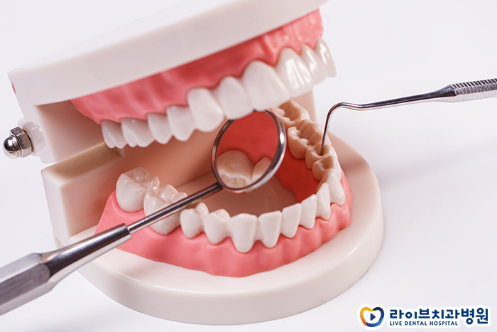 구강유산균 효능이 뭘까 관련 이미지 2