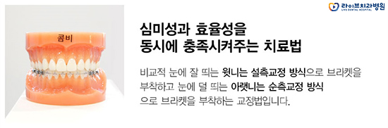 콤비교정 선택하려는 이유는? 관련 이미지 3