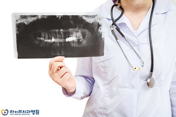 임플란트가격 요점을 파악하자 관련 이미지 5