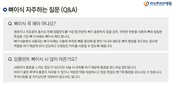 임플란트 뼈이식 꼭 해야되는 걸까요? 관련 이미지 4