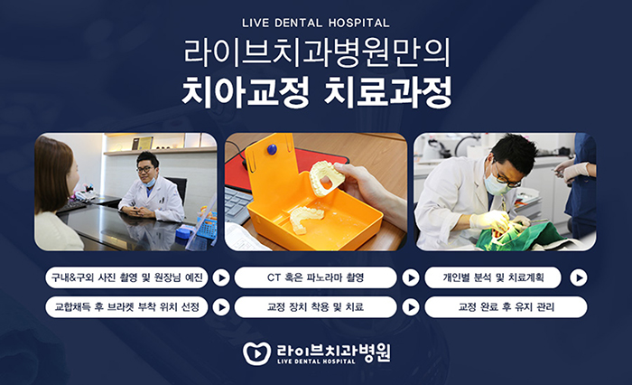 방배동치과 치아교정 고민하신다면 관련 이미지 3