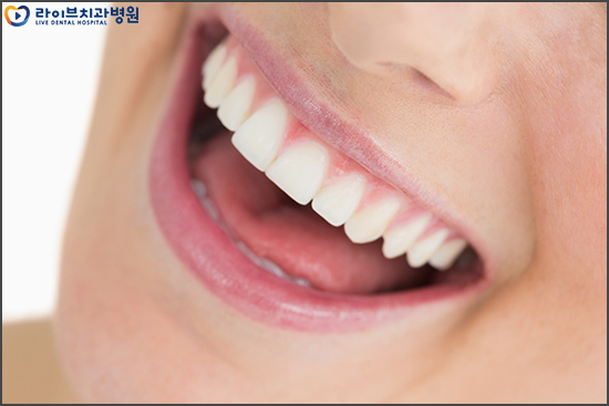 비발치교정, 발치 없는 교정을 생각한다면 관련 이미지 2