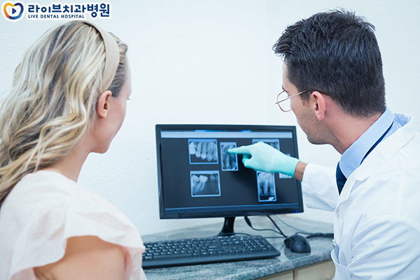 임플란트추천 고민없이 시작하자 관련 이미지 4