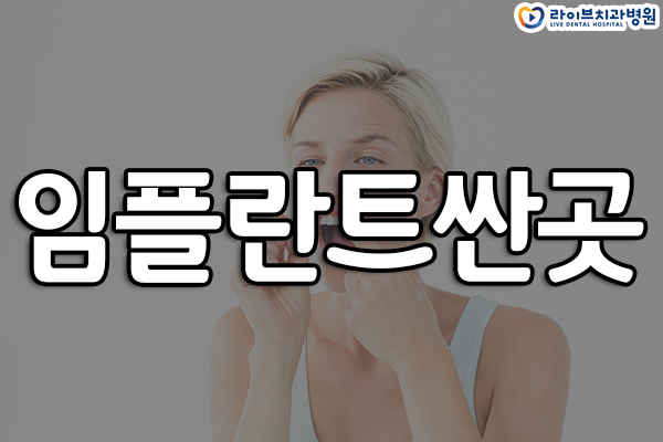강남임플란트싼곳 부담없이! 관련 이미지 1