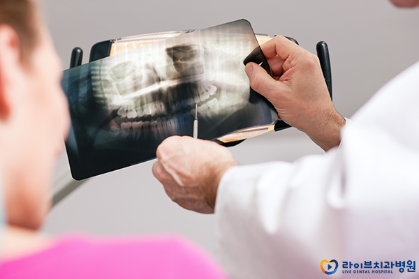 임플란트가격 요점을 파악하자 관련 이미지 3