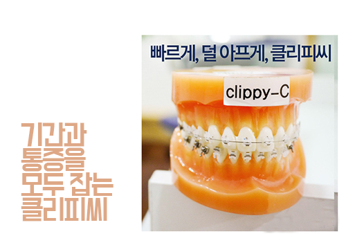 클리피씨 교정으로 시간을 아낀다? 관련 이미지 5