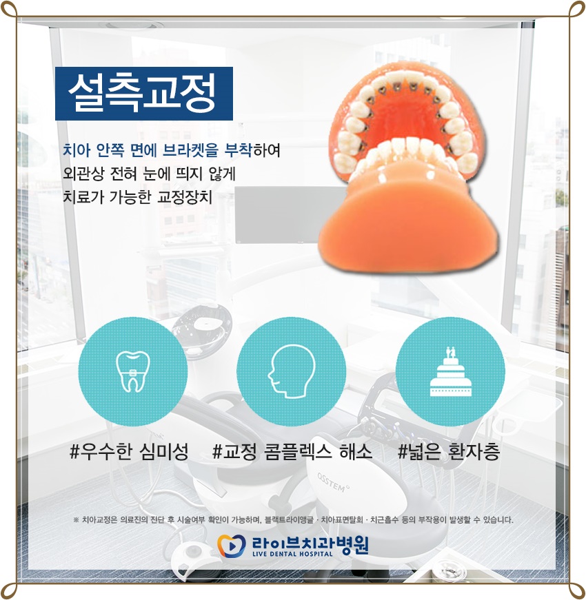 치아교정장치종류 알맞게 교정받자! 관련 이미지 4