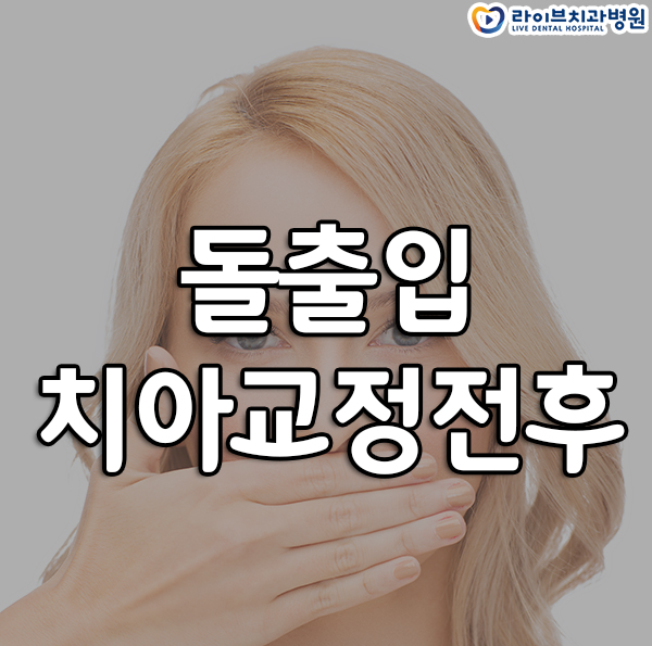 돌출입치아교정전후 얼마나 달라지나요? 관련 이미지 1