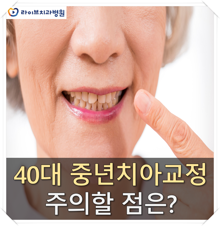40대 중년치아교정 주의할 점은? 관련 이미지 1