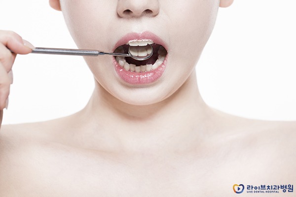 치아교정관리 유지하는 방법은? 관련 이미지 4