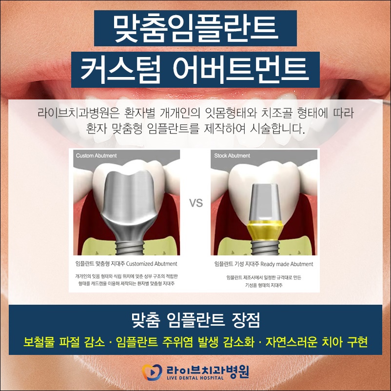 임플란트재수술 선택을 앞두고 있다면? 관련 이미지 8