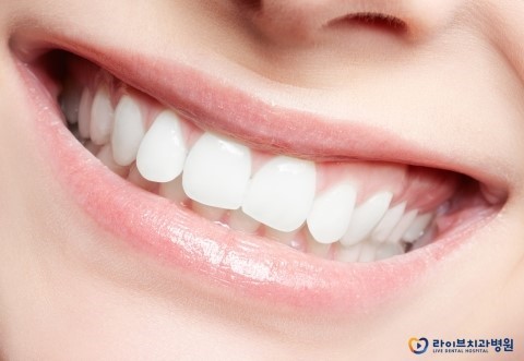 교정유지장치, 이보다 더 중요할 순 없다! 관련 이미지 2