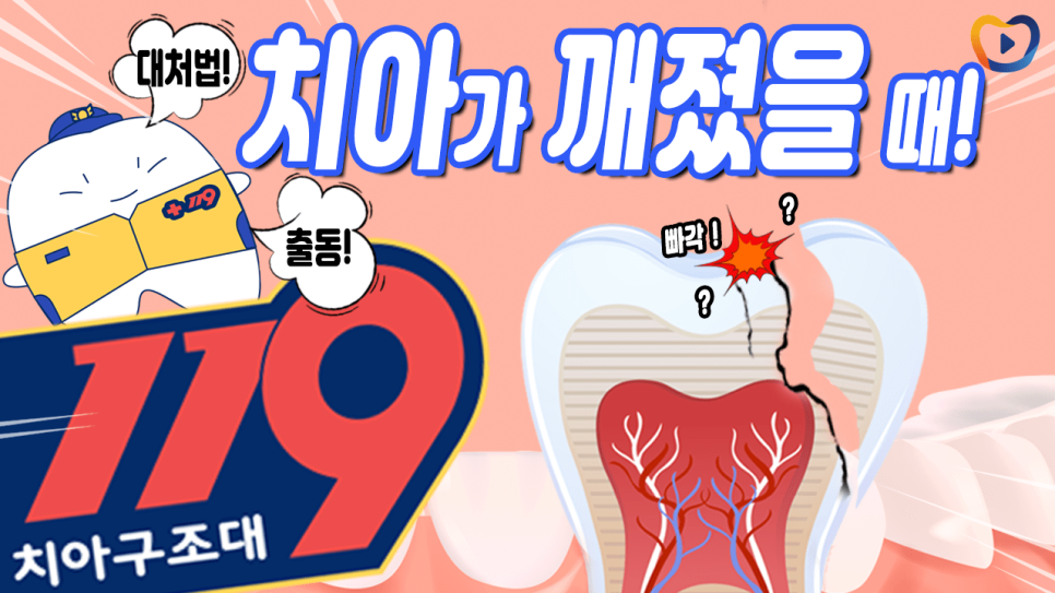 [119치아구조대] 치아가 깨졌을 때!?ㅣ깨진 순간부터 치료까지 올바른 대처법!ㅣ대처법ㅣ치료방법ㅣ레진 관련 이미지 1
