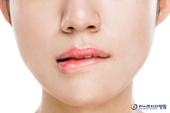 돌출입교정, 콤플렉스를 해소하는 방법 관련 이미지 2