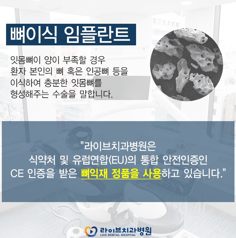 인천 임플란트 찾고 있다면 라이브 치과가 정답이다^^ 관련 이미지 4