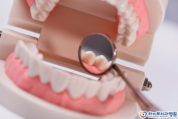 부정교합 교정비용 얼마나 될까요? 관련 이미지 3