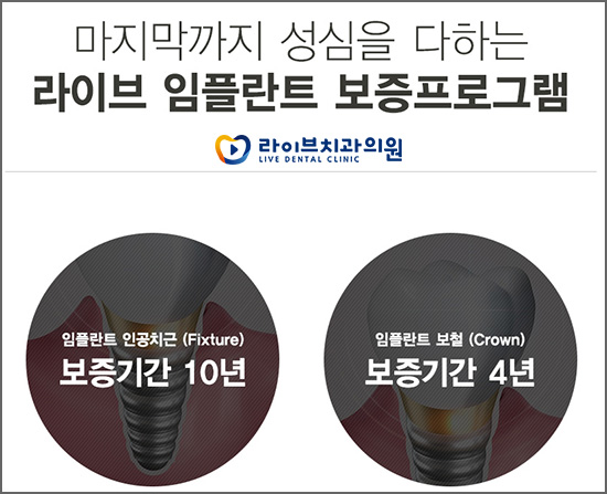 부평임플란트 받기 전 확인해보자 관련 이미지 5