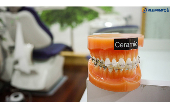 세라믹교정, 부평치과는 이곳에서! 관련 이미지 4