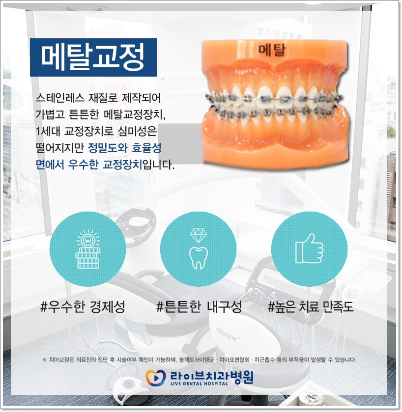 치아교정비용 종류에 따라서 관련 이미지 2