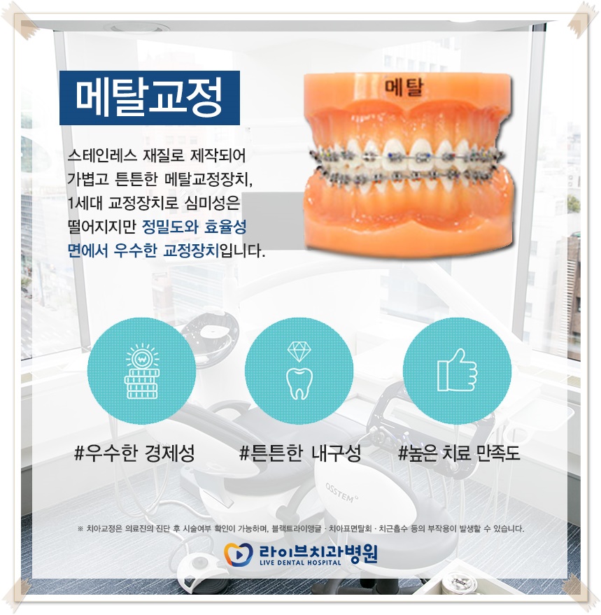 치아교정종류 상황에 맞게! 관련 이미지 6