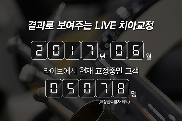 치아교정잘하는곳 궁금하신가요? 관련 이미지 4