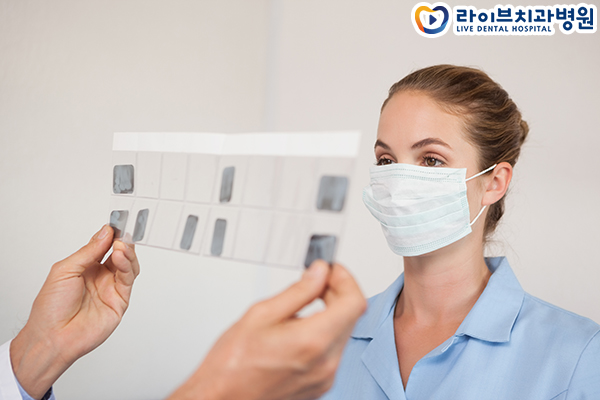 어금니임플란트비용 고민되네요 관련 이미지 4