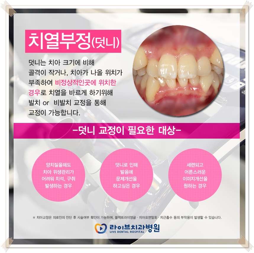 치아교정종류 상황에 맞게! 관련 이미지 5
