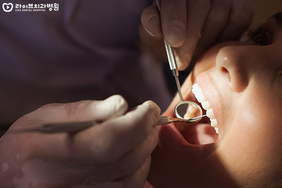 발치교정, 비발치교정이 결정되는 요인은? 관련 이미지 5