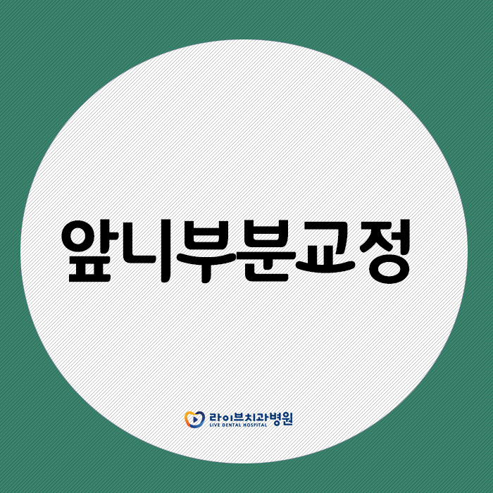 앞니부분교정, 부담없이 원하는 부위만 확실하게 관련 이미지 1