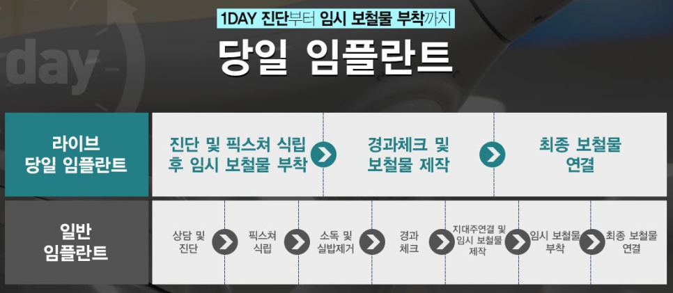 부평치과 임플란트 어디로가야할까? 관련 이미지 3