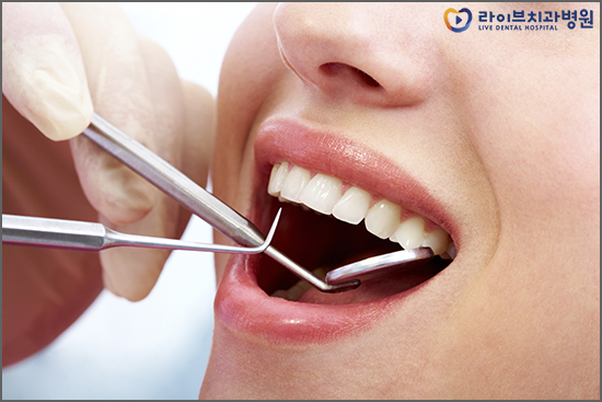 임플란트종류 차이점에 대해서 알아보자 관련 이미지 2