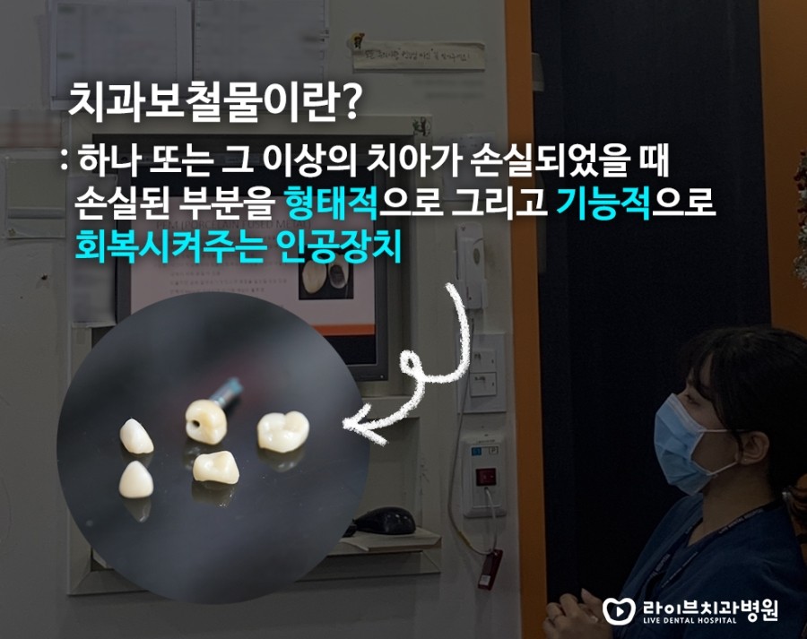 [6월세미나]보철물에 대하여-강남점 스텝세미나 관련 이미지 2