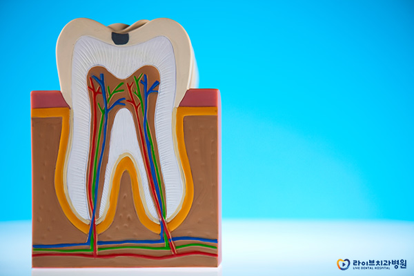 임플란트뼈이식 필요한 이유를 알아보자! 관련 이미지 4