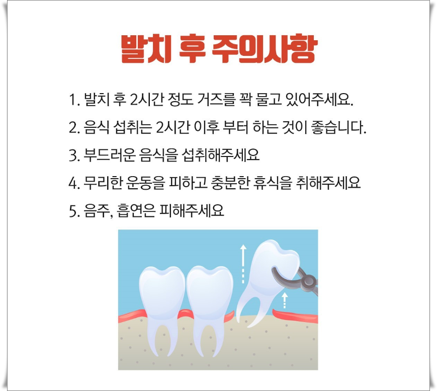 사랑니 유형과 발치 후 주의사항 정보 관련 이미지 5