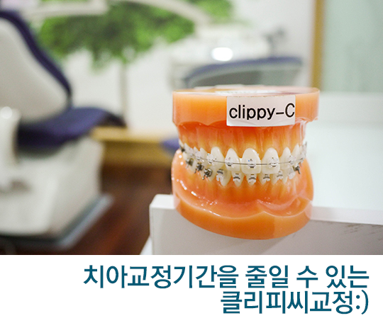 치아교정기간, 왜 모두 같지 않을까? 관련 이미지 5